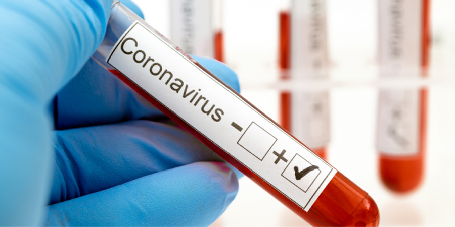 Tájékoztatás a koronavírus elleni hatósági intézkedésekről